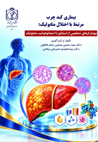 بیماری کبد چرب مرتبط با اختلال متابولیک